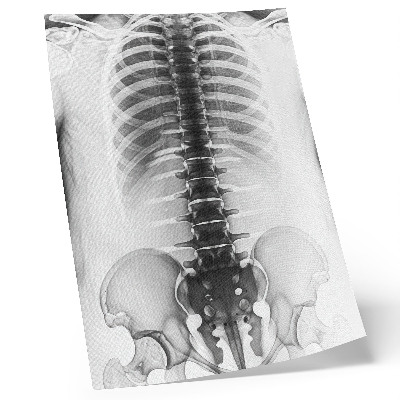Sieninis plakatas Skeletas juodai baltai